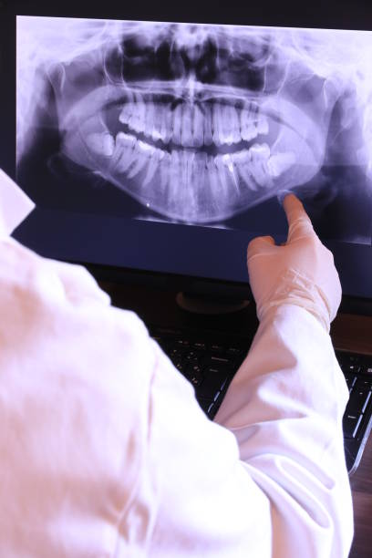 Best Emergency Wisdom Teeth Removal in Garden Ridge, TX